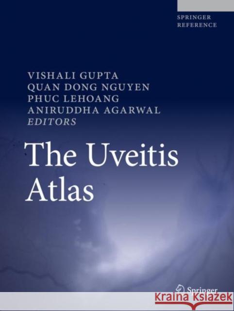 The Uveitis Atlas Vishali Gupta Quan Dong Nguyen Phuc Lehoang 9788132224099 Springer - książka