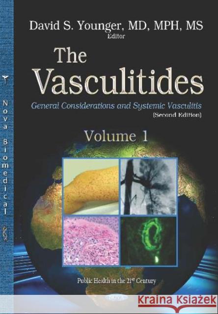 The Vasculitides: Volume 1 -- General Considerations and Systemic Vasculitis David Steven Younger   9781536151336 Nova Science Publishers Inc - książka