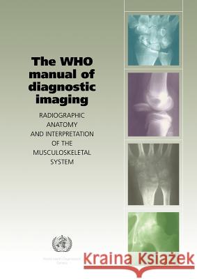 The Who Manual of Diagnostic Imaging: Radiographic Anatomy and Interpretation of the Musculoskeletal System Davies, A. M. 9789241545556 World Health Organization - książka
