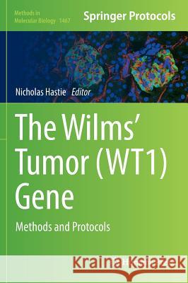 The Wilms' Tumor (Wt1) Gene: Methods and Protocols Hastie, Nicholas 9781493940219 Humana Press - książka