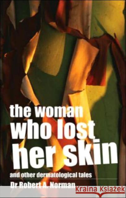 The Woman Who Lost Her Skin: (And Other Dermatological Tales) Norman, Rob 9780415343565 Routledge - książka