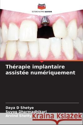Therapie implantaire assistee numeriquement Daya D Shetye Suyog Dharmadhikari Arvind Shetty 9786206069775 Editions Notre Savoir - książka