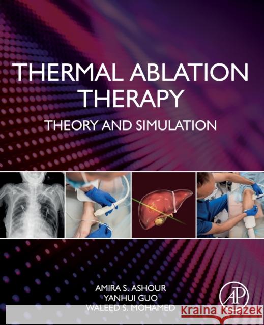 Thermal Ablation Therapy: Theory and Simulation Amira S. Ashour Yanhui Guo Waleed Samy Dawoud 9780128195444 Academic Press - książka