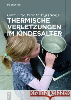 Thermische Verletzungen im Kindesalter Guido Fitze Peter M. Vogt 9783110442847 de Gruyter - książka