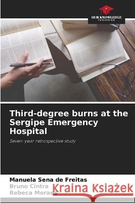 Third-degree burns at the Sergipe Emergency Hospital Manuela Sena de Freitas Bruno Cintra Rebeca Moraes 9786206043010 Our Knowledge Publishing - książka