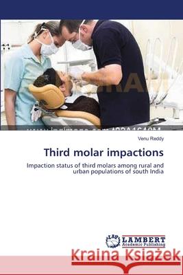 Third molar impactions Reddy, Venu 9783659156427 LAP Lambert Academic Publishing - książka