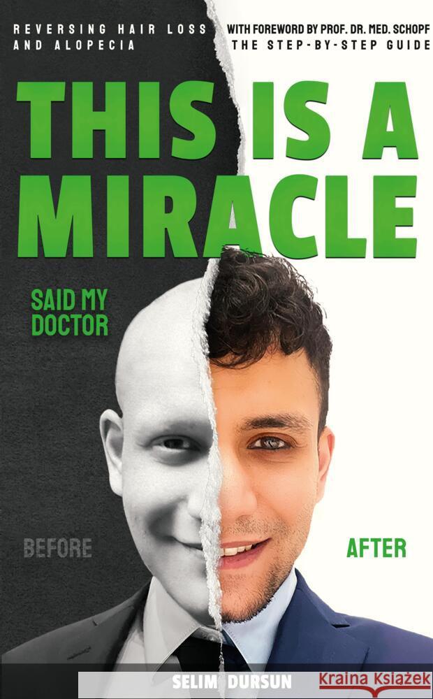 This Is a Miracle Said My Doctor: Reversing Hair Loss and Alopecia Selim Dursun 9783384063434 Hawloo - książka