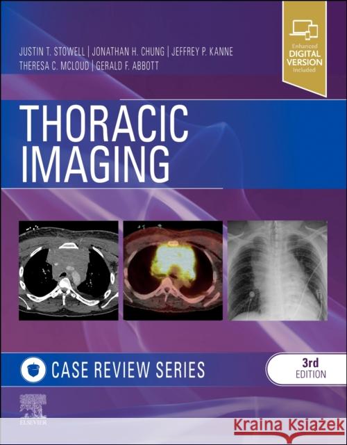 Thoracic Imaging: Case Review Gerald F. Abbott Jonathan Hero Chung Jeffrey P. Kanne 9780323428798 Elsevier - Health Sciences Division - książka