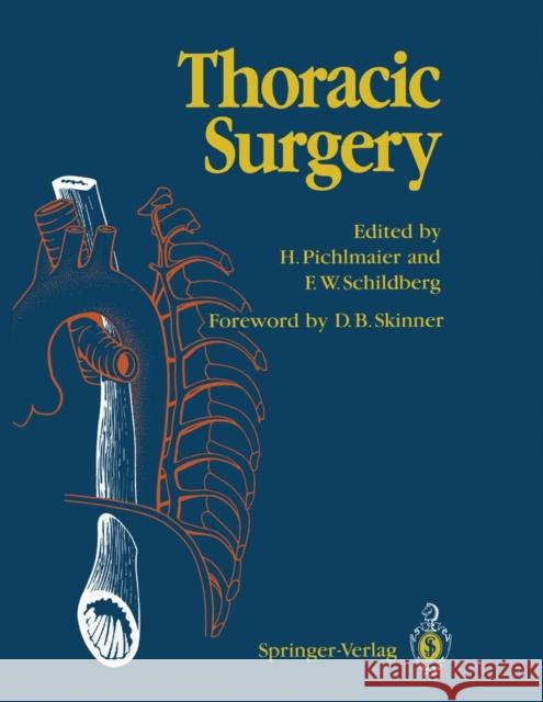 Thoracic Surgery: Surgical Procedures on the Chest and Thoracic Cavity Pichlmaier, H. 9783642489891 Springer - książka