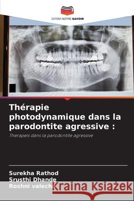 Thérapie photodynamique dans la parodontite agressive : Rathod, Surekha, Dhande, Srusthi, valecha, Roshni 9786209312076 Editions Notre Savoir - książka