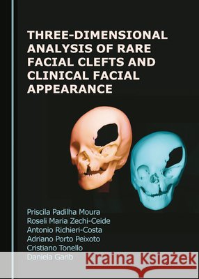Three-Dimensional Analysis of Rare Facial Clefts and Clinical Facial Appearance Adriano Porto Peixoto, Antonio Richieri-Costa, Priscila Padilha Moura 9781527552265 Cambridge Scholars Publishing (RJ) - książka