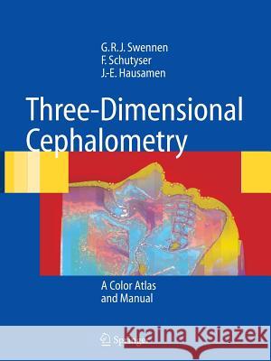 Three-Dimensional Cephalometry: A Color Atlas and Manual Swennen, Gwen R. J. 9783642064845 Springer - książka