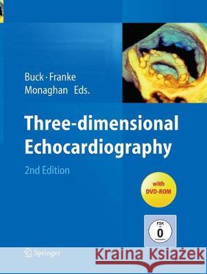 Three-Dimensional Echocardiography Buck, Thomas 9783662519790 Springer - książka