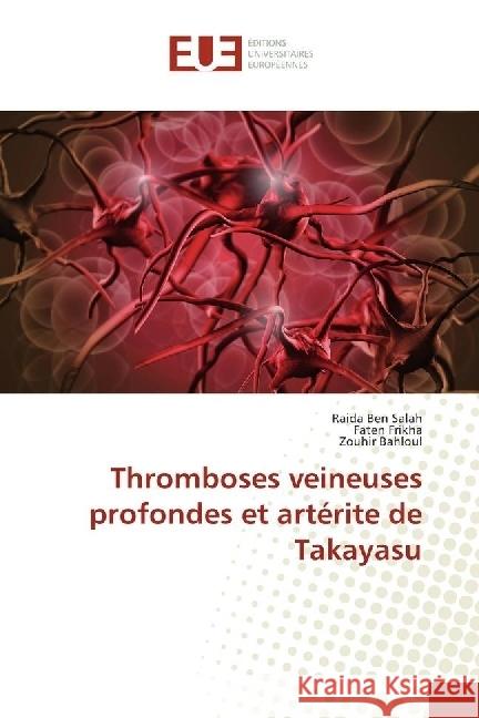 Thromboses veineuses profondes et artérite de Takayasu Ben Salah, Raida; Frikha, Faten; Bahloul, Zouhir 9783841617514 Éditions universitaires européennes - książka