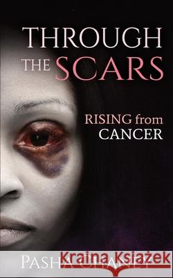 Through the Scars: Rising from Cancer Pasha Chaney 9780578717401 Bed Roc - książka