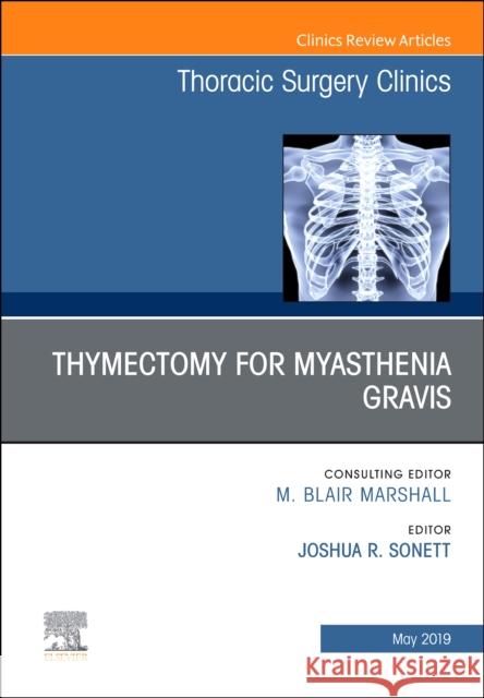Thymectomy in Myasthenia Gravis, an Issue of Thoracic Surgery Clinics: Volume 29-2 Sonett, Joshua R. 9780323678292 Elsevier - książka