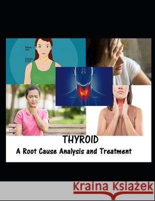 Thyroid: A Root Cause Analysis and Treatment Ravi Kiran 9798529859957 Independently Published - książka