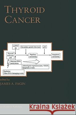 Thyroid Cancer James A. Fagin 9780792383260 Springer Netherlands - książka