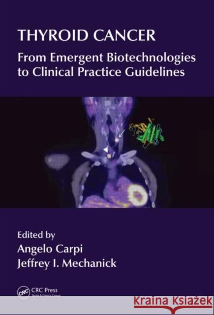 Thyroid Cancer : From Emergent Biotechnologies to Clinical Practice Guidelines Jeffrey I. Mechanick Angelo Carpi 9781439862216 CRC Press - książka