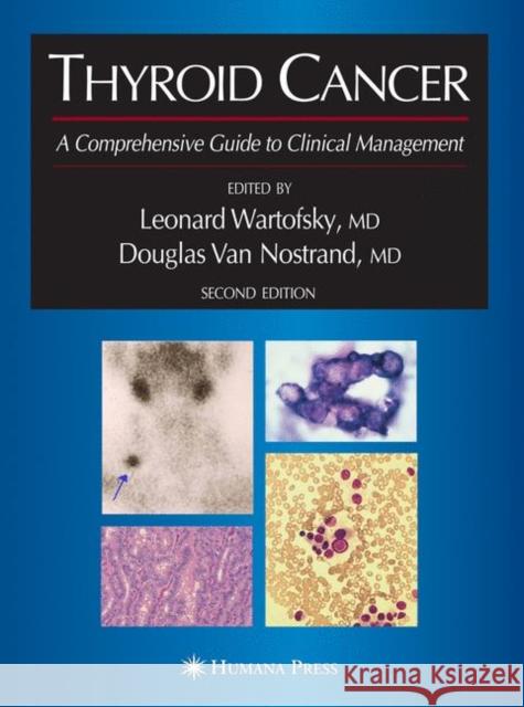Thyroid Cancer: A Comprehensive Guide to Clinical Management Wartofsky, Leonard 9781617375835 Springer - książka