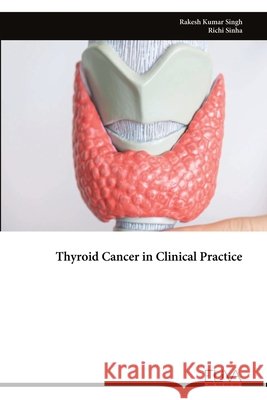 Thyroid Cancer in Clinical Practice Rakesh Kumar Singh Richi Sinha 9789999343275 Eliva Press - książka