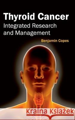 Thyroid Cancer: Integrated Research and Management Benjamin Copes 9781632424044 Foster Academics - książka