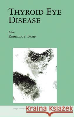 Thyroid Eye Disease Rebecca S. Bahn Rebecca S. Bahn 9780792373803 Springer Netherlands - książka