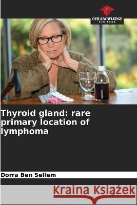 Thyroid gland: rare primary location of lymphoma Dorra Ben Sellem   9786205817452 Our Knowledge Publishing - książka