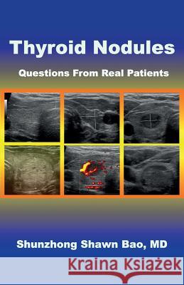 Thyroid Nodules: Questions From Real Patients Winter, Barbara 9780999732205 Ace Health Publisher - książka