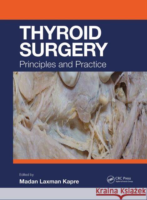 Thyroid Surgery: Principles and Practice Madan Kapre 9781032242910 CRC Press - książka