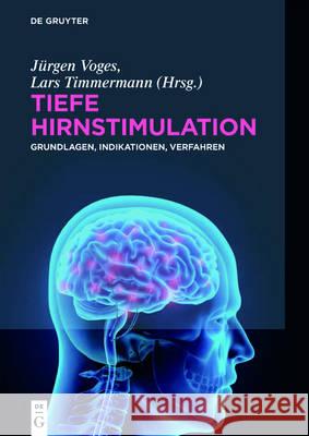 Tiefe Hirnstimulation Voges, Jürgen 9783110458763 de Gruyter - książka