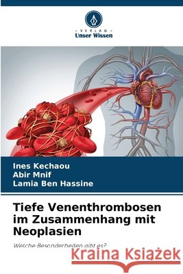 Tiefe Venenthrombosen im Zusammenhang mit Neoplasien Kechaou, Ines, Mnif, Abir, Ben Hassine, Lamia 9786209548284 Verlag Unser Wissen - książka