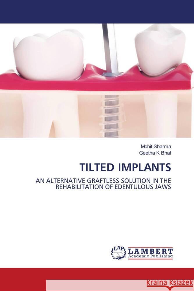 Tilted Implants Sharma, Mohit, Bhat, Geetha K 9786203863314 LAP Lambert Academic Publishing - książka