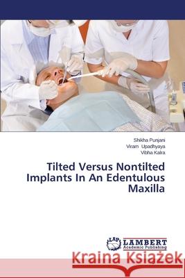 Tilted Versus Nontilted Implants In An Edentulous Maxilla Punjani Shikha 9783659497766 LAP Lambert Academic Publishing - książka