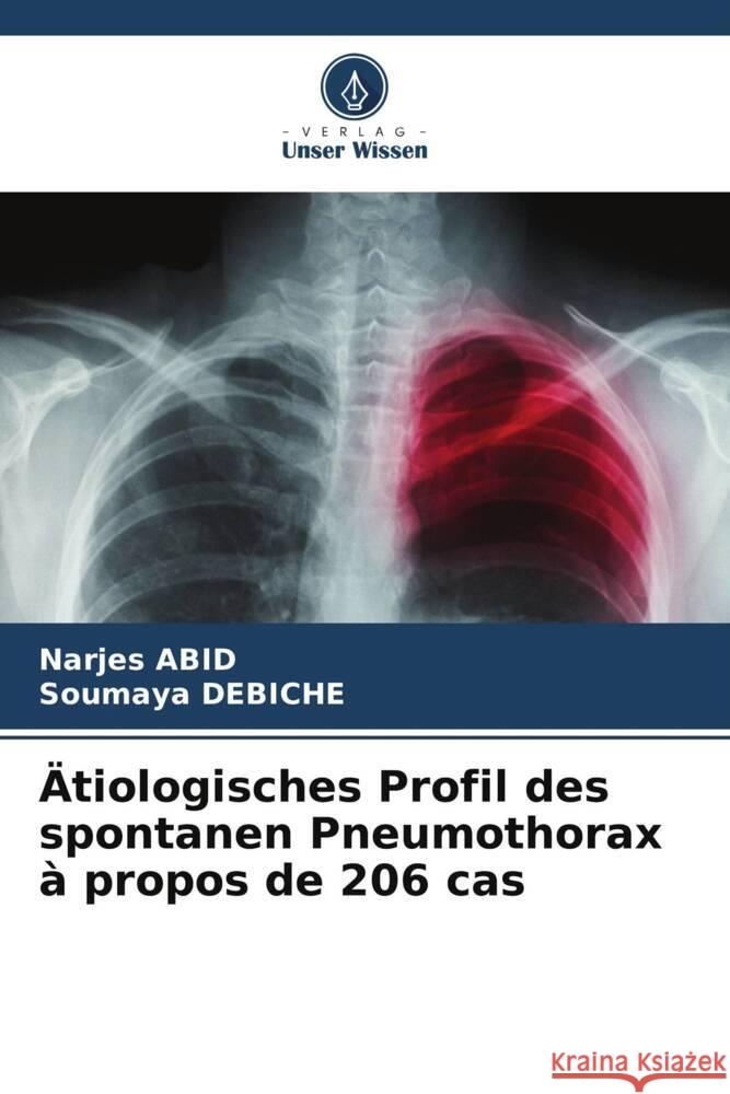 Ätiologisches Profil des spontanen Pneumothorax à propos de 206 cas Abid, Narjes, Debiche, Soumaya 9786208382490 Verlag Unser Wissen - książka