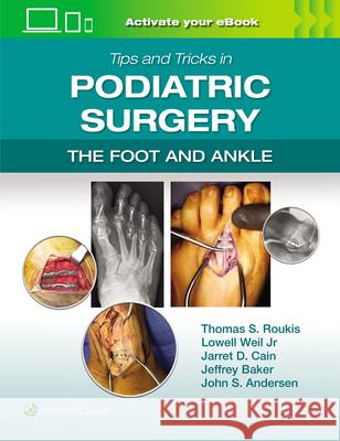 Tips and Tricks in Podiatric Surgery: The Foot and Ankle: Print + eBook with Multimedia Thomas S. Roukis Lowell Weil Jarrett Cain 9781975240592 LWW - książka