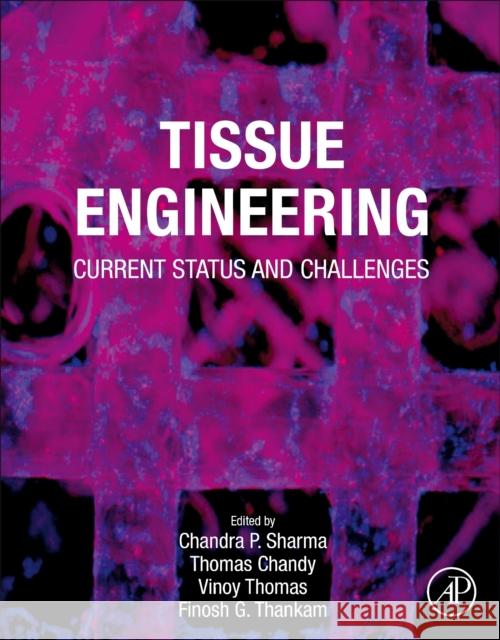 Tissue Engineering: Current Status and Challenges Chandra P. Sharma Thomas Chandy Vinoy Thomas 9780128240649 Academic Press - książka