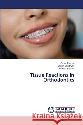 Tissue Reactions In Orthodontics Sharma, Ankur; Upadhyay, Sachin; Sharma, Aseem 9786137379578 LAP Lambert Academic Publishing - książka