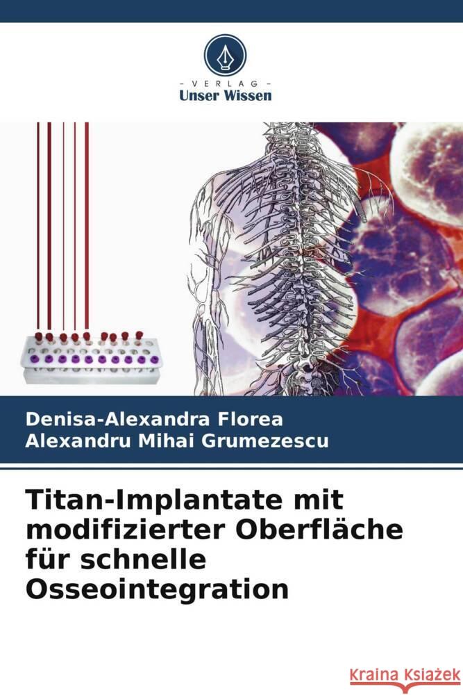 Titan-Implantate mit modifizierter Oberfläche für schnelle Osseointegration Florea, Denisa-Alexandra, Grumezescu, Alexandru Mihai 9786208640101 Verlag Unser Wissen - książka