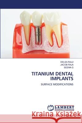 Titanium Dental Implants Delsa Raju Jacob Raja Seema G 9786203464344 LAP Lambert Academic Publishing - książka