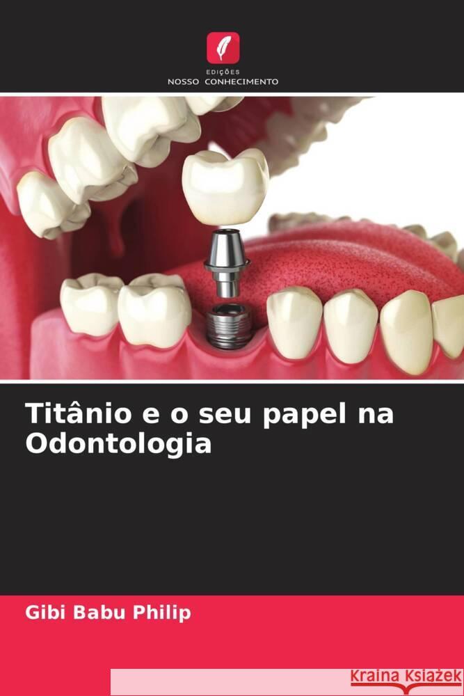 Titânio e o seu papel na Odontologia Philip, Gibi Babu 9786205572573 Edições Nosso Conhecimento - książka