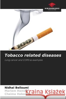 Tobacco related diseases Nidhal Belloumi, Mariem Hamdi, Chaima Habouria 9786205264324 Our Knowledge Publishing - książka