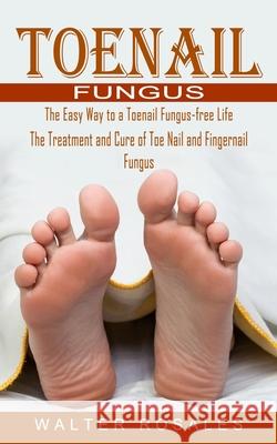 Toenail Fungus: The Easy Way to a Toenail Fungus-free Life (The Treatment and Cure of Toe Nail and Fingernail Fungus) Walter Rosales 9781774854709 Jordan Levy - książka