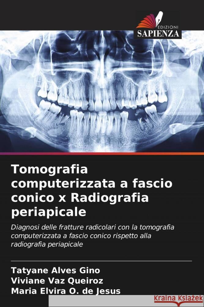 Tomografia computerizzata a fascio conico x Radiografia periapicale Alves Gino, Tatyane, Vaz Queiroz, Viviane, O. de Jesus, Maria Elvira 9786206417194 Edizioni Sapienza - książka