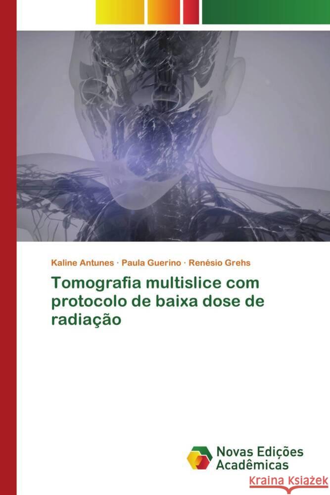 Tomografia multislice com protocolo de baixa dose de radia??o Kaline Antunes Paula Guerino Ren?sio Grehs 9786206759416 Novas Edicoes Academicas - książka