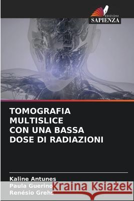 Tomografia Multislice Con Una Bassa Dose Di Radiazioni Kaline Antunes Paula Guerino Ren?sio Grehs 9786207516858 Edizioni Sapienza - książka