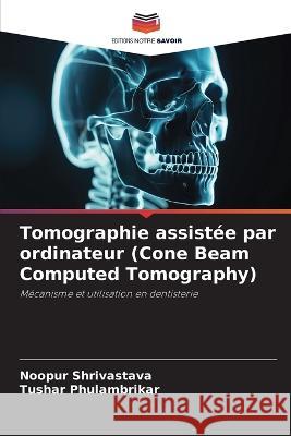 Tomographie assistee par ordinateur (Cone Beam Computed Tomography) Noopur Shrivastava Tushar Phulambrikar  9786206140436 Editions Notre Savoir - książka