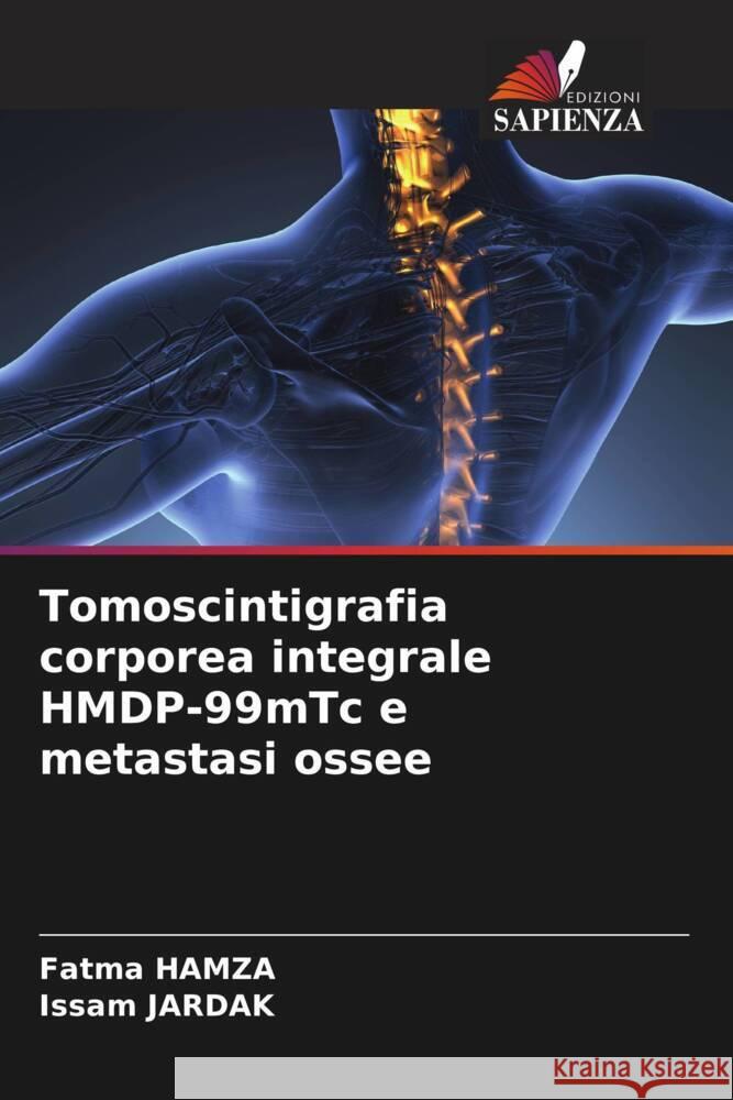Tomoscintigrafia corporea integrale HMDP-99mTc e metastasi ossee HAMZA, Fatma, JARDAK, Issam 9786205569375 Edizioni Sapienza - książka
