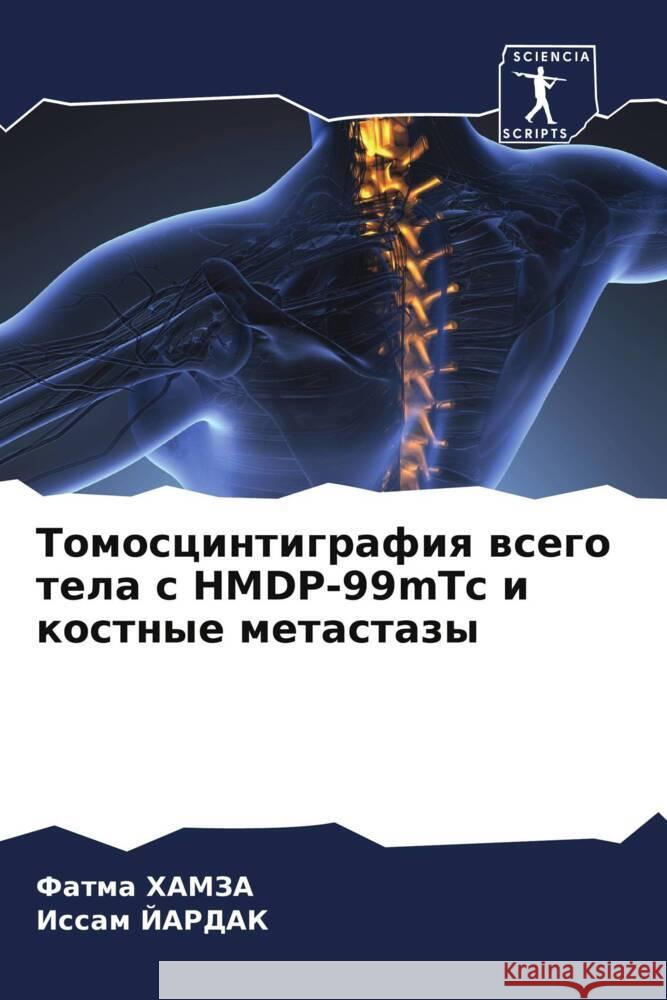 Tomoscintigrafiq wsego tela s HMDP-99mTc i kostnye metastazy HAMZA, Fatma, JARDAK, Issam 9786205569399 Sciencia Scripts - książka
