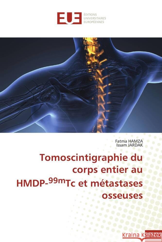 Tomoscintigraphie du corps entier au HMDP-99mTc et métastases osseuses HAMZA, Fatma, JARDAK, Issam 9786203429176 Éditions universitaires européennes - książka